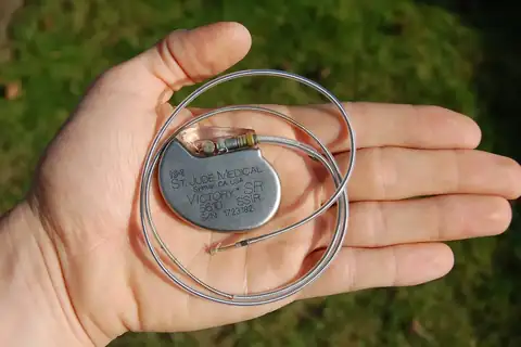 A silver St. Jude Medical pacemaker with thin coiled wire leads resting in an open palm